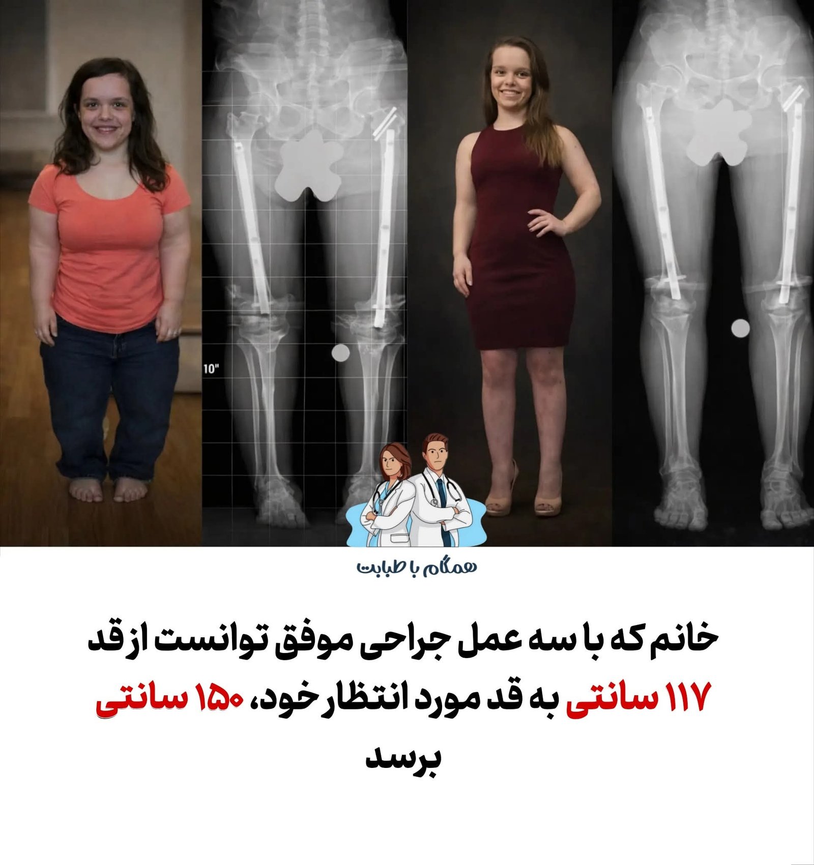 جالب بلند کردن قد