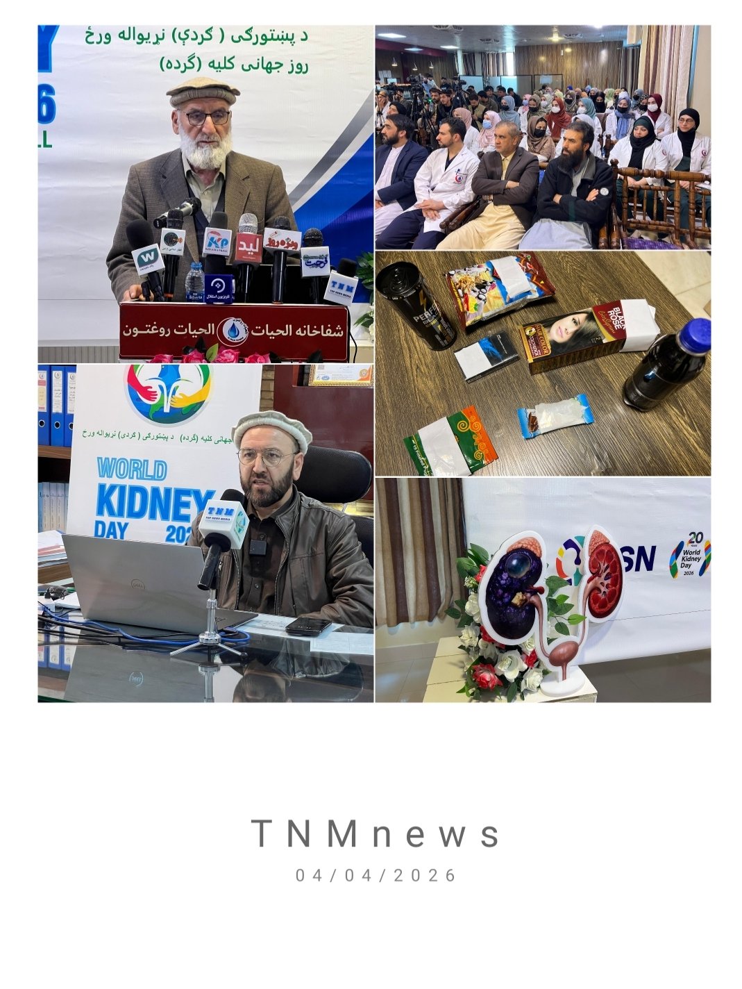 روز جهانی کلیه